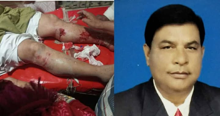 বাঘায় প্রাইভেটকারের ধাক্কায় বিএনপি নেতার ভাই গুরুতর আহত